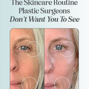 Stacked Skincare Microneedling Tool + 2 Replacement Roller Heads